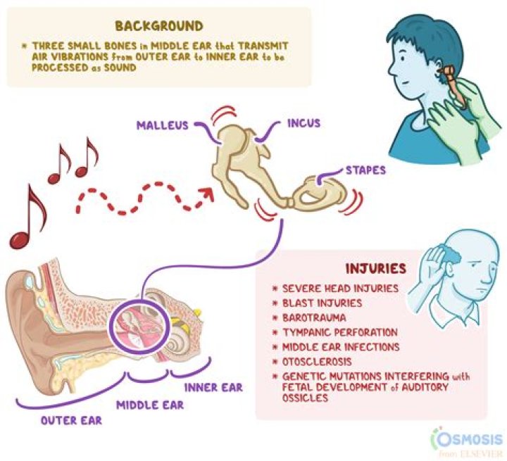 What does it mean when you hear a popping noise?